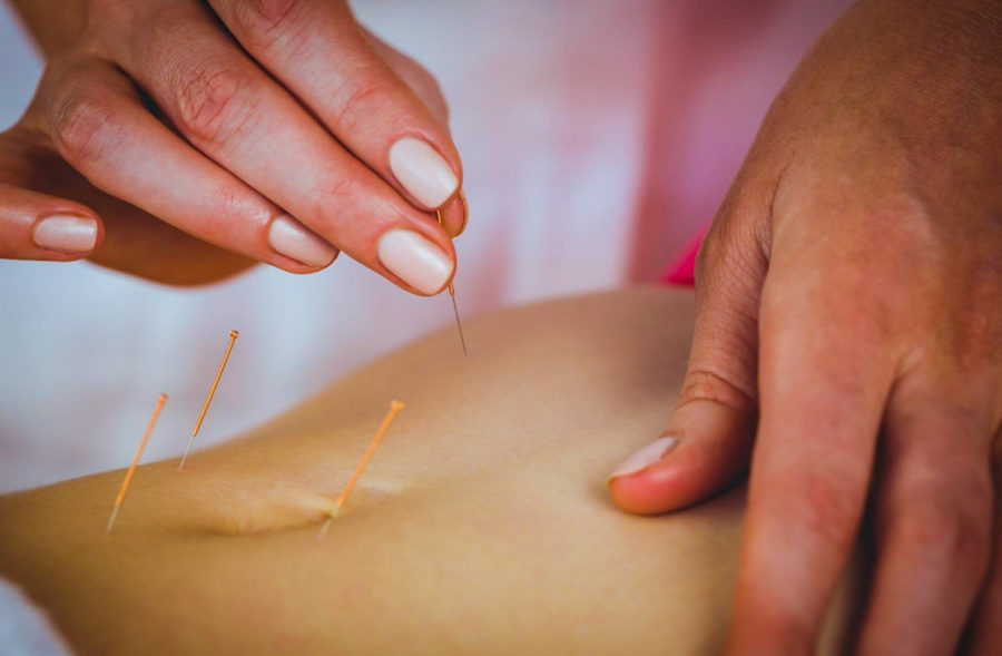 Иглорефлексотерапия в санатории «Солнечный» в Кисловодске - фотография